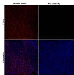CD8a Antibody in Immunohistochemistry (Paraffin) (IHC (P))