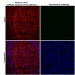 CD20 Antibody in Immunohistochemistry (Paraffin) (IHC (P))