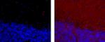 CD56 (NCAM) Antibody in Immunohistochemistry (Paraffin) (IHC (P))