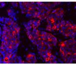 Mouse IgG (H+L) Secondary Antibody in Immunohistochemistry (Paraffin) (IHC (P))