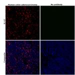 Ki-67 Antibody in Immunohistochemistry (Paraffin) (IHC (P))