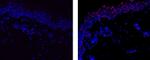 RUNX3 Antibody in Immunohistochemistry (Paraffin) (IHC (P))