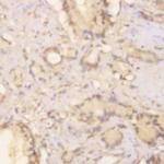 Phosphoserine Antibody in Immunohistochemistry (Paraffin) (IHC (P))
