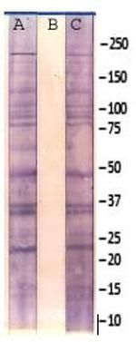 Phosphoserine Antibody in Western Blot (WB)