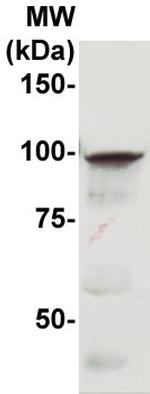 CD10 Antibody in Western Blot (WB)