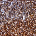 CD45/LCA Antibody in Immunohistochemistry (Paraffin) (IHC (P))