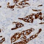 FGFR-2 Antibody in Immunohistochemistry (Paraffin) (IHC (P))