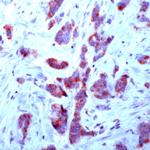 FGFR-1 Antibody in Immunohistochemistry (Paraffin) (IHC (P))