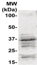 Cyclin G1 Antibody in Western Blot (WB)