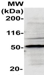 Blk Antibody in Western Blot (WB)