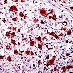 ALK/p80 Antibody in Immunohistochemistry (Paraffin) (IHC (P))