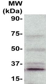 CD9 Antibody in Western Blot (WB)