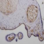 TGF beta Receptor III Antibody in Immunohistochemistry (Paraffin) (IHC (P))