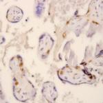 TGF beta Receptor II Antibody in Immunohistochemistry (Paraffin) (IHC (P))