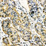 Calcitonin Antibody in Immunohistochemistry (Paraffin) (IHC (P))