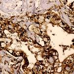 Phospho-BCL-XL (Ser62) Antibody in Immunohistochemistry (Paraffin) (IHC (P))