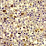 Phospho-ELK1 (Ser389) Antibody in Immunocytochemistry (ICC/IF)