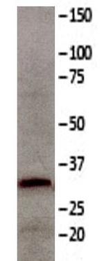 Calretinin Antibody in Western Blot (WB)