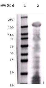 Phospho-c-erbB2 (HER2) (Tyr1221, Tyr1222) Antibody in Western Blot (WB)
