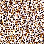 Phospho-JunB (Ser259) Antibody in Immunocytochemistry (ICC/IF)