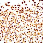 Phospho-NF-kB p100/p52 (Ser866) Antibody in Immunocytochemistry (ICC/IF)