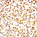 Phospho-NF-kB p105/p50 (Ser893) Antibody in Immunocytochemistry (ICC/IF)