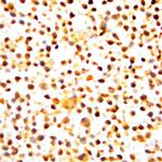 Phospho-NF-kB p105/p50 (Ser907) Antibody in Immunocytochemistry (ICC/IF)