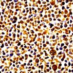 Phospho-NF-kB p65 (Ser276) Antibody in Immunocytochemistry (ICC/IF)