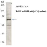 Phospho-NF-kB p65 (Ser276) Antibody in Western Blot (WB)
