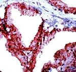 Phospho-NF-kB p65 (Thr254) Antibody in Immunocytochemistry (ICC/IF)