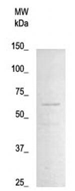 Phospho-NF-kB p65 (Thr254) Antibody in Western Blot (WB)