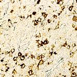 CD15 Antibody in Immunohistochemistry (Paraffin) (IHC (P))