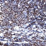 CD1a Antibody in Immunohistochemistry (Paraffin) (IHC (P))