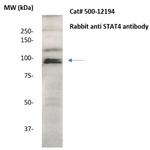 STAT4 Antibody in Western Blot (WB)