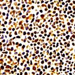 Phospho-ELK-1 (Ser383) Antibody in Immunocytochemistry (ICC/IF)
