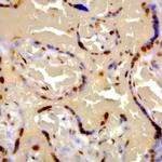 Phospho-IGF-1R (Tyr1161) Antibody in Immunohistochemistry (Paraffin) (IHC (P))