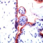 TGF beta R1 Antibody in Immunohistochemistry (Paraffin) (IHC (P))