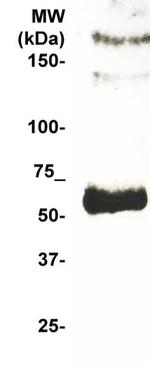 TGF beta R1 Antibody in Western Blot (WB)