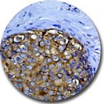 c-erbB-2/HER-2 Antibody in Immunohistochemistry (Paraffin) (IHC (P))