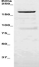 c-erbB-2/HER-2 Antibody in Western Blot (WB)