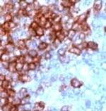 CD3 Antibody in Immunohistochemistry (Paraffin) (IHC (P))