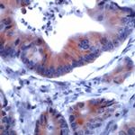 IRS-1 Antibody in Immunohistochemistry (Paraffin) (IHC (P))