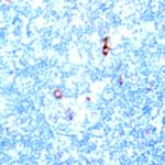 CD31 (PECAM) Antibody in Immunohistochemistry (Paraffin) (IHC (P))