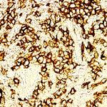CD30 Antibody in Immunohistochemistry (Paraffin) (IHC (P))