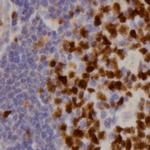 CD25 Antibody in Immunohistochemistry (Paraffin) (IHC (P))