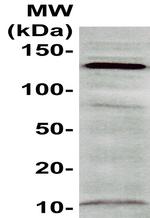 CD29 Antibody in Western Blot (WB)