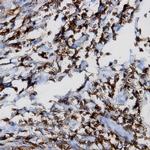 p18/INK4C Antibody in Immunohistochemistry (Paraffin) (IHC (P))