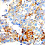 Chromogranin B Antibody in Immunohistochemistry (Paraffin) (IHC (P))