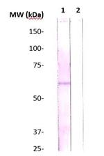 Estrogen Receptor alpha (ER-alpha) Antibody in Western Blot (WB)