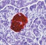 Insulin Antibody in Immunohistochemistry (Paraffin) (IHC (P))